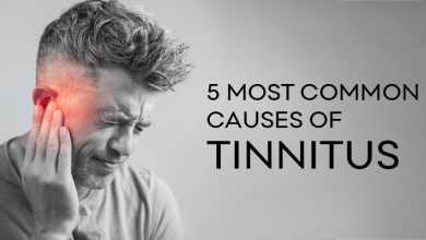 COMMON CAUSES OF TINNITUS