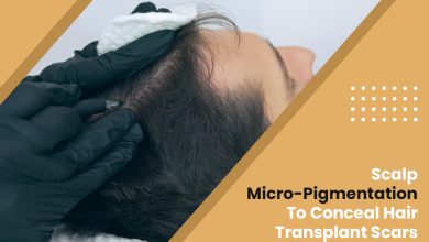 Scalp Micro-Pigmentation To Conceal Hair Transplant Scars